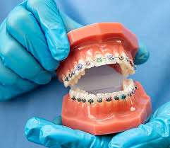 idcc dental